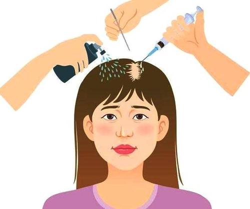 脱发要怎么治疗才有效_海口治脱发的方法
